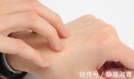 健康|身体出现4个异常，说明痛风在加剧，做好3事，多半可以缓解