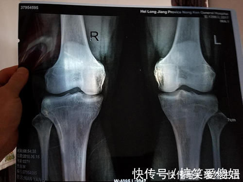 信号|当孩子出现这3个信号,说明长身高进入倒计时,早发现早“冲刺”