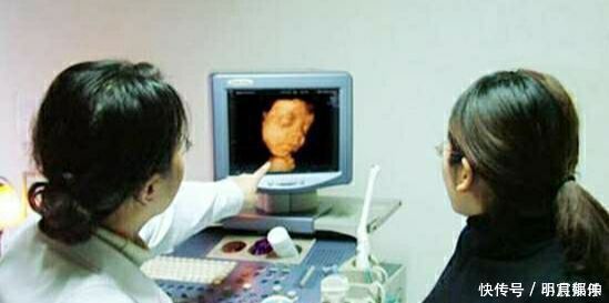 发育|迫不及待想看孩子,四维彩超时宝宝却比个“v”,医生忍不住笑了