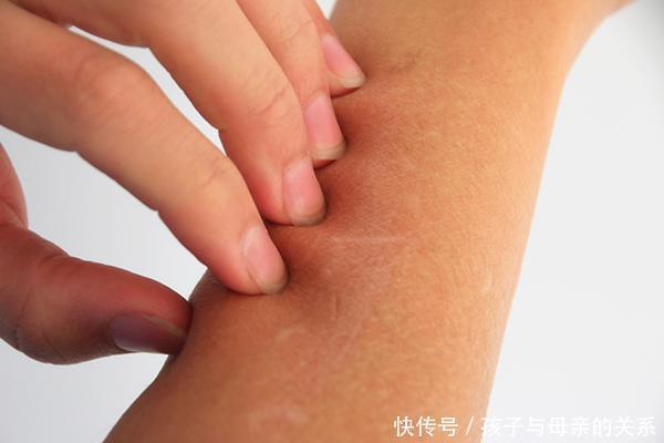 从确诊到离世,半年不到,胆管癌为何如此“凶狠”?医生说实话