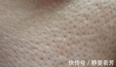 控油|“大油田”与“毛孔粗大”是亲生兄弟,几招轻松对付他们
