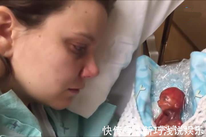 宝宝|14年前那个世上最小婴儿,看到如今颜值后,真令人羡慕!