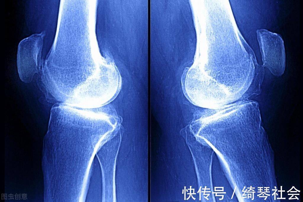 孩子|冬季是孩子“转骨期”,想要身高再窜一窜,这3件事上要多下功夫