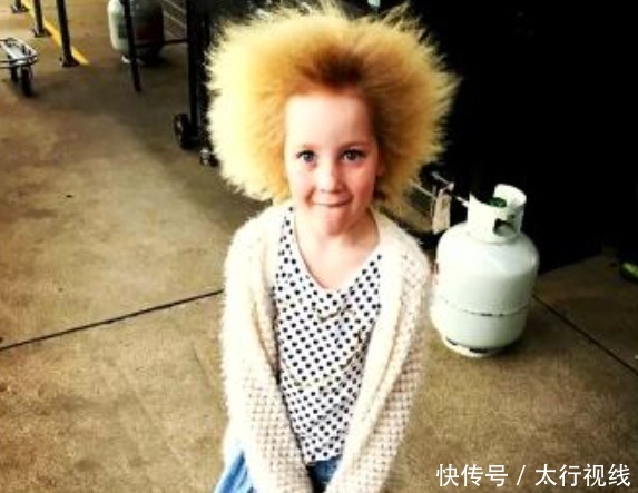 安德伍德|因患有难梳头发综合征,这个小女孩,拥有了爱因斯坦同款发型