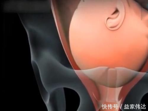 羊膜囊|顺产的全过程到底是怎样的,生而为人需了解,请勿泪奔