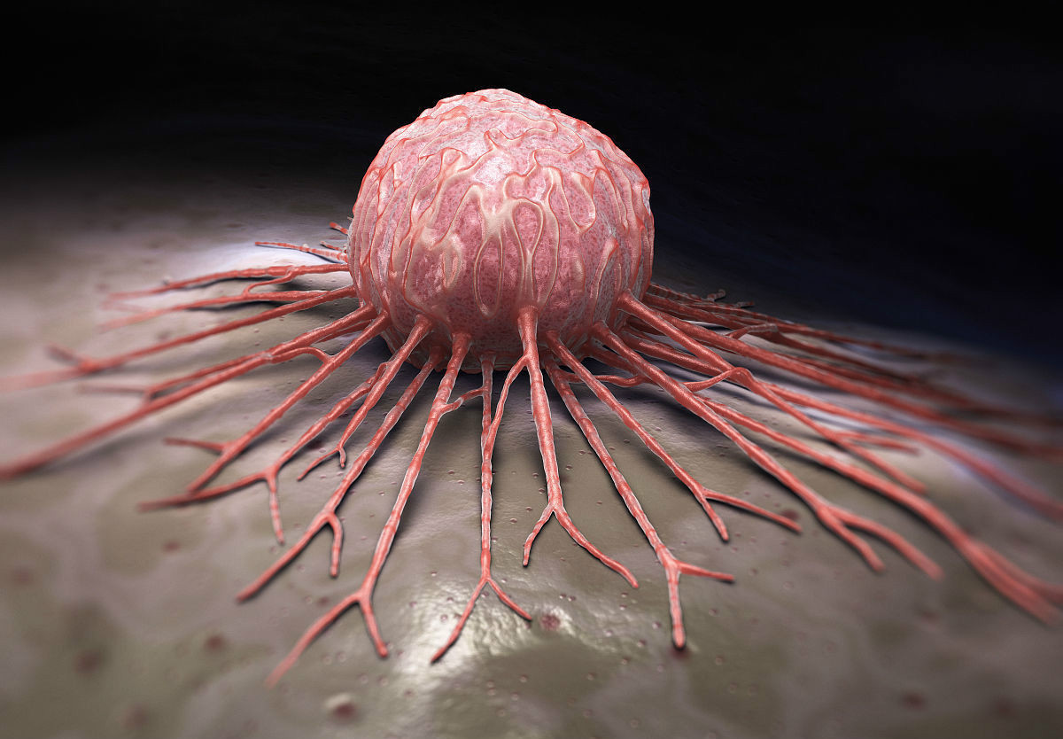 元凶|终于找到癌症的元凶了，肿瘤科医生提醒，四个部位最好每年体检