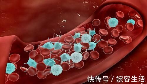 血管堵塞|它被称为血管的“清理员”,每天吃一点,帮你疏通血管,远离血栓