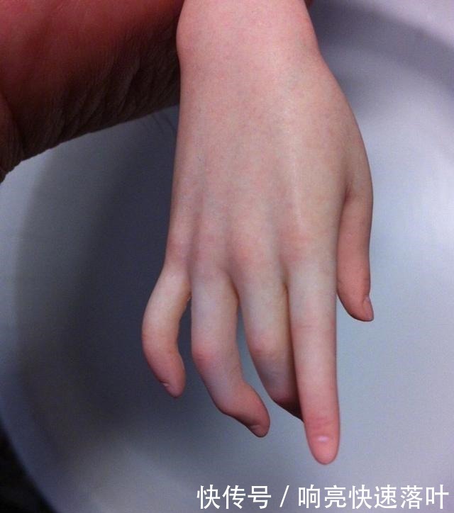 血管|日本匠人做手办,逼真到血管都清晰可见,却被人误会是糖王的作品!