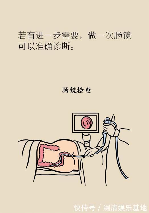 筛查|50岁以后高发的癌症,这5类人提前10年筛查,就能避免太多悲剧