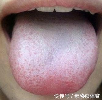 茯苓|养脸不如养脾，3样健脾祛湿好物，一定要吃