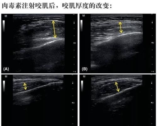 你周围大脸的女生多吗？拥有一张大脸是种怎样的感受？