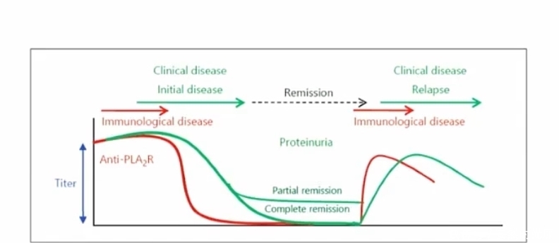 不做肾穿刺,如何诊断病理类型?2项检查大