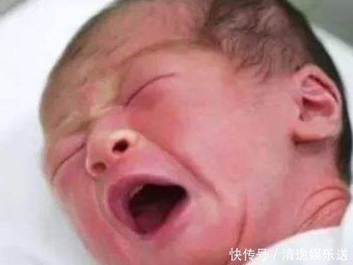 宝宝出生后没黄疸，八成是孕妈在孕期做了3件事，对大人孩子都好