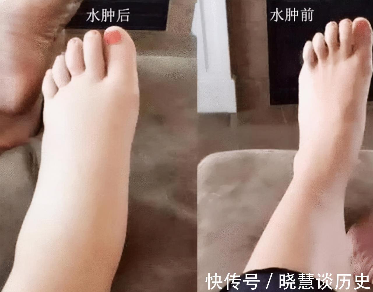 万精油|黄芪泡水好处多多,但这3种人尽量不要喝黄芪泡水,平时要注意