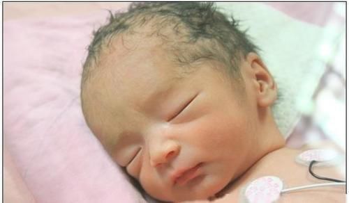 罗医生|经过了一夜的待产,终于要跟宝贝见面了,我的剖腹产记录