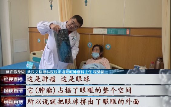 李女士|女子眼睛鼓得像鸡蛋，竟是因为这种病