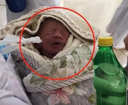 分娩|宝宝生下来就没有肛门，宝妈连忙送医，医生这得怪你的丈夫