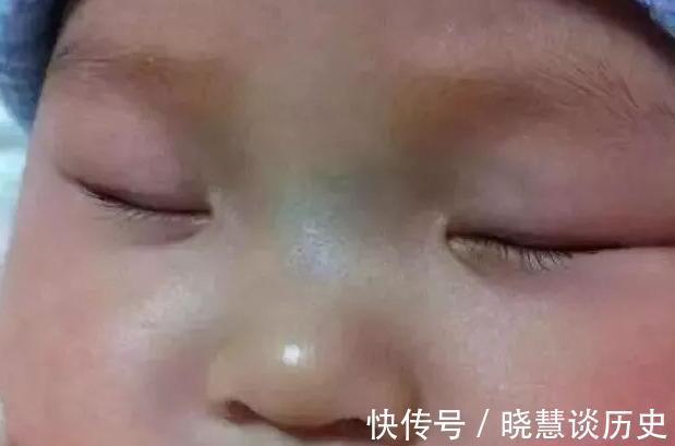 添加剂|孩子积食难消化,脸上或有3种变化,不忌口4种食物,娃身高难长