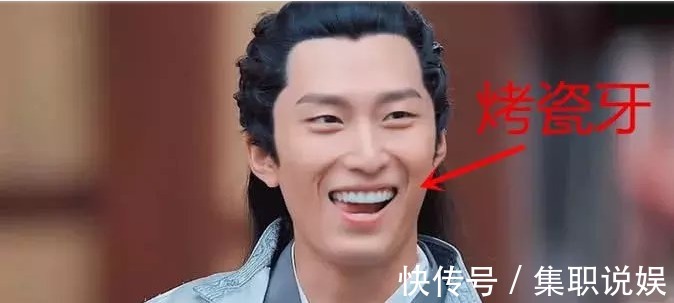 牙套|为什么明星的牙齿又白又齐, 普通人却“带点黄” 牙医给出答案