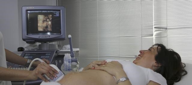 唐氏筛查|为何越来越多的孕妇不愿意去产检,原因即现实又扎心,你知道吗
