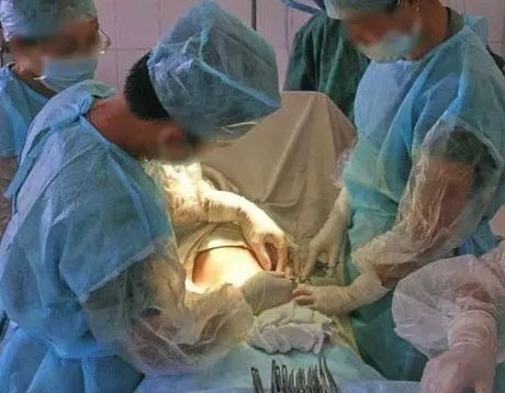 产妇|什么是备皮？什么是小牛奶？了解这些产房暗语，避免尴尬