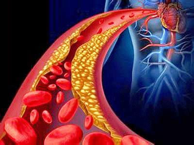一日三餐|人到中年要养生，三个坚持，两个不要，一个畅通，为你助力