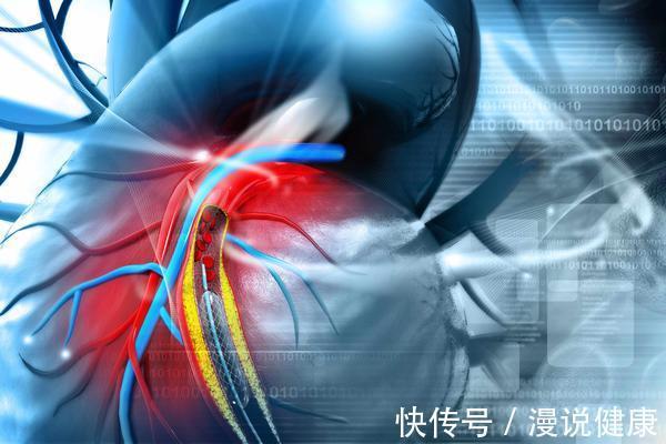 医生|它被称为:心肺血管领域的癌症!我们该如何应对?医生一文说清