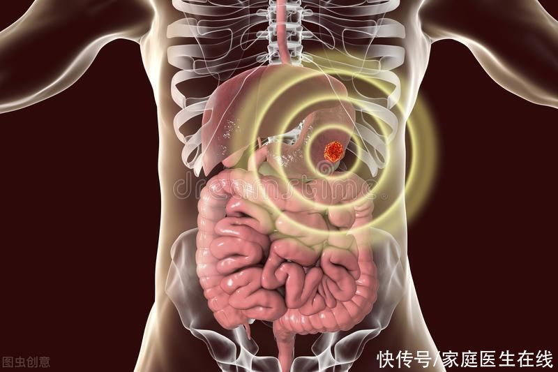 国人|我国人最该防住“消化道癌”？这6种常见的癌症不可不防！别轻视