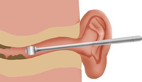 耳朵出现异常褶皱或是暗示人体心脏出现问题，中医教你如何鉴别