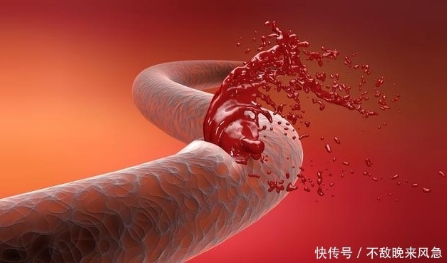 血液粘稠|血液为什么粘稠?多半是吃出来的,医生奉劝,这3类食物,不要碰