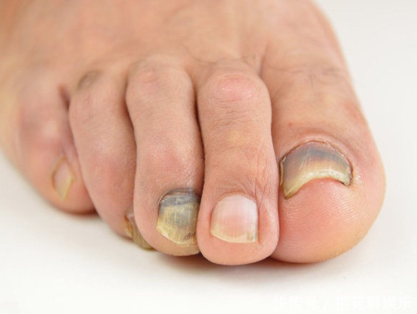 癌症来降临前,多伴有4种信号,教你3招,提前预防癌症,望周知