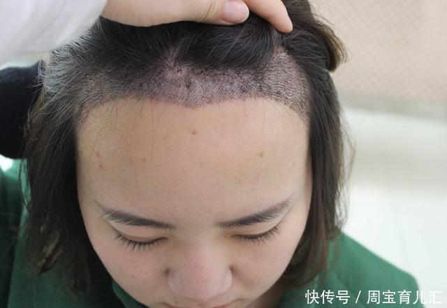 耳垂|宝宝这3个部位越“大”越好,全中堪称是“福相”,中一个也很好