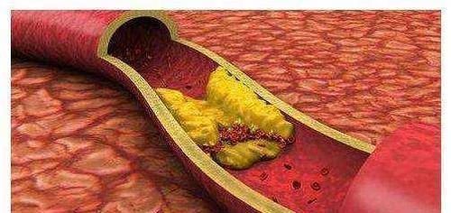 什么时候吃核桃抗衰老效果最好?每天吃多少核桃才合理?了解一下