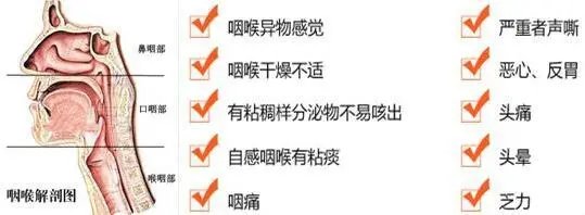 扁桃体周围炎|咽口水都痛，晚上睡不好…咽喉痛，不容忽视
