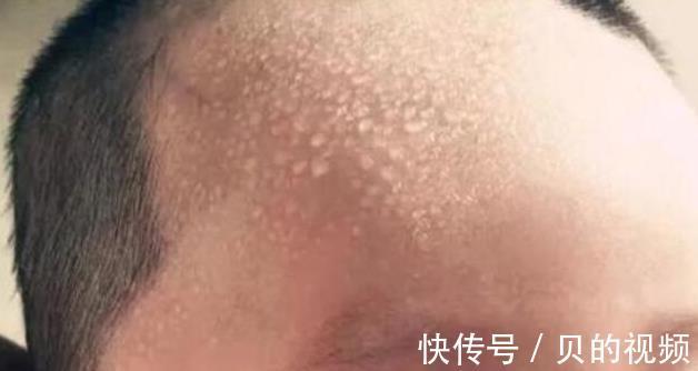 身高|9岁男童身高只有121厘米,医生:无知父母,总让娃吃3种饭