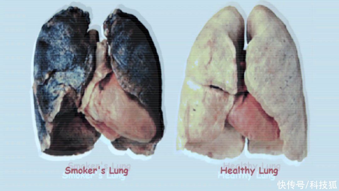 辐射 地球上辐射最强的地方，是吸烟者的肺