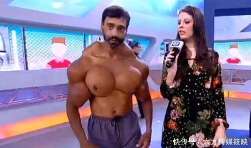 不忍直视|为了练出肌肉，巴西男子往肌肉注射燃油，如今形象不忍直视