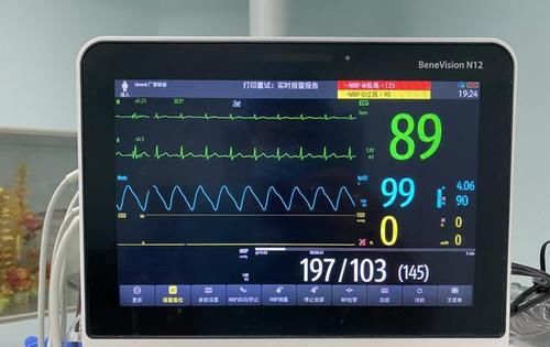 要点|高血压,你会使用电子血压计吗?你知道家庭自测血压的要点吗?