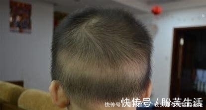 营养均衡|怎么知道宝宝缺钙?宝宝缺钙会有这些表现,宝妈发现了吗?