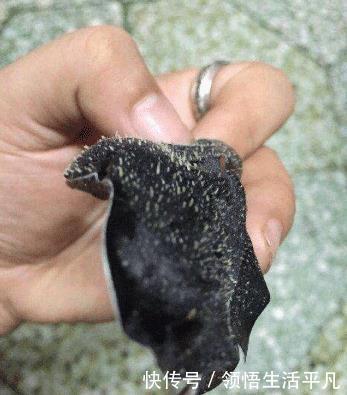 鼻子上挤出来的白色物体是什么皮肤科医生给出这些忠告