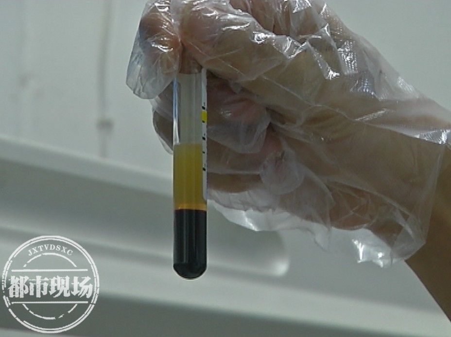 胰腺|江西一女子突发急性胰腺炎，都是太嗨惹的祸