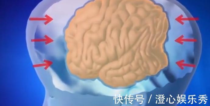 治疗|3岁女童头重达20斤,手术刚要进行,家人却放弃治疗准备寿衣