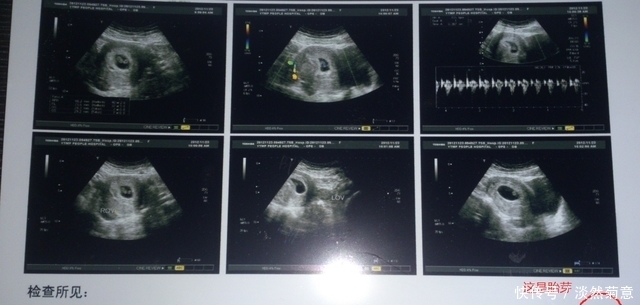 怀孕12周|孕期280天产检要点：时间、项目、注意事项，收藏这篇就够用了