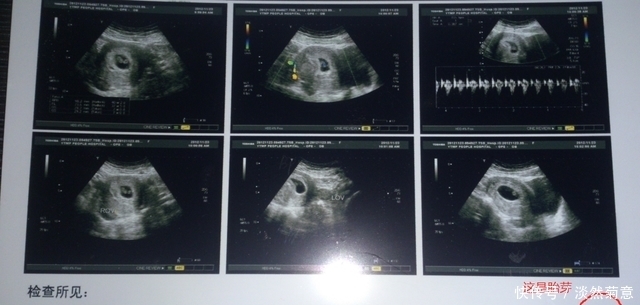 怀孕12周|孕期280天产检要点:时间、项目、注意事项,收藏这篇就够用了
