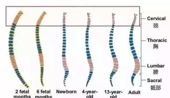 新生儿被诊断脊柱变形，这几个习惯容易伤害孩子，宝妈尽快改正