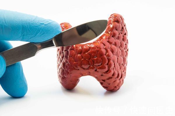 恶性|甲状腺癌是“善良癌”，恶性程度低，发展速度慢，但发现后早处理