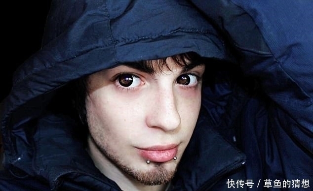 皮肤|男子花23万削尖耳朵漂白皮肤,每月花3万护理只为成现实中精灵