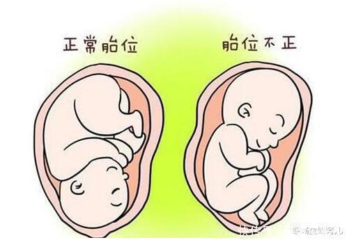 产妇|为什么越来越多的女明星选择剖腹产，而不愿意顺产生娃，原因在这