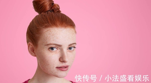 维生素c|几块钱的红霉素软膏成了“祛斑专家”?想要祛斑,你不妨这样做