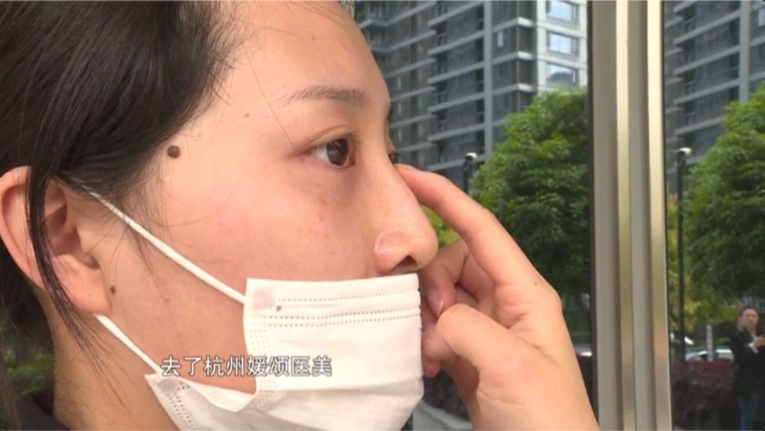 3天就变回原样！女子花高价注射玻尿酸中的“爱马仕”，结果却入了个“无底洞”